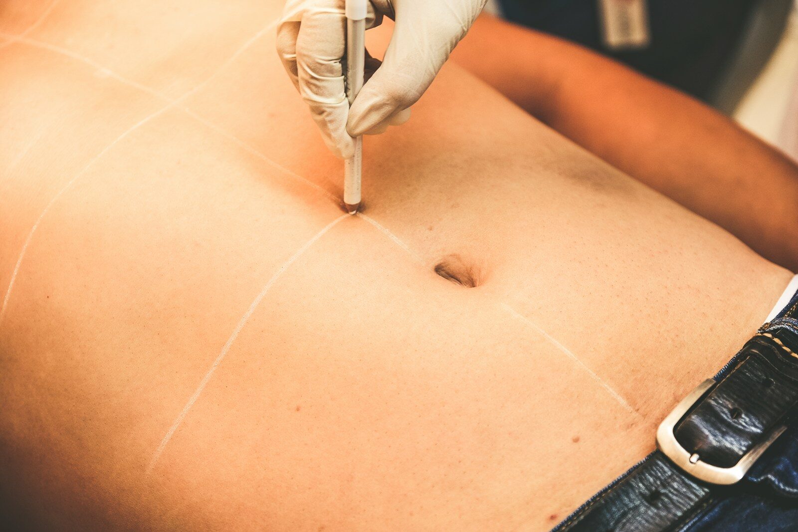 a person getting a tattoo